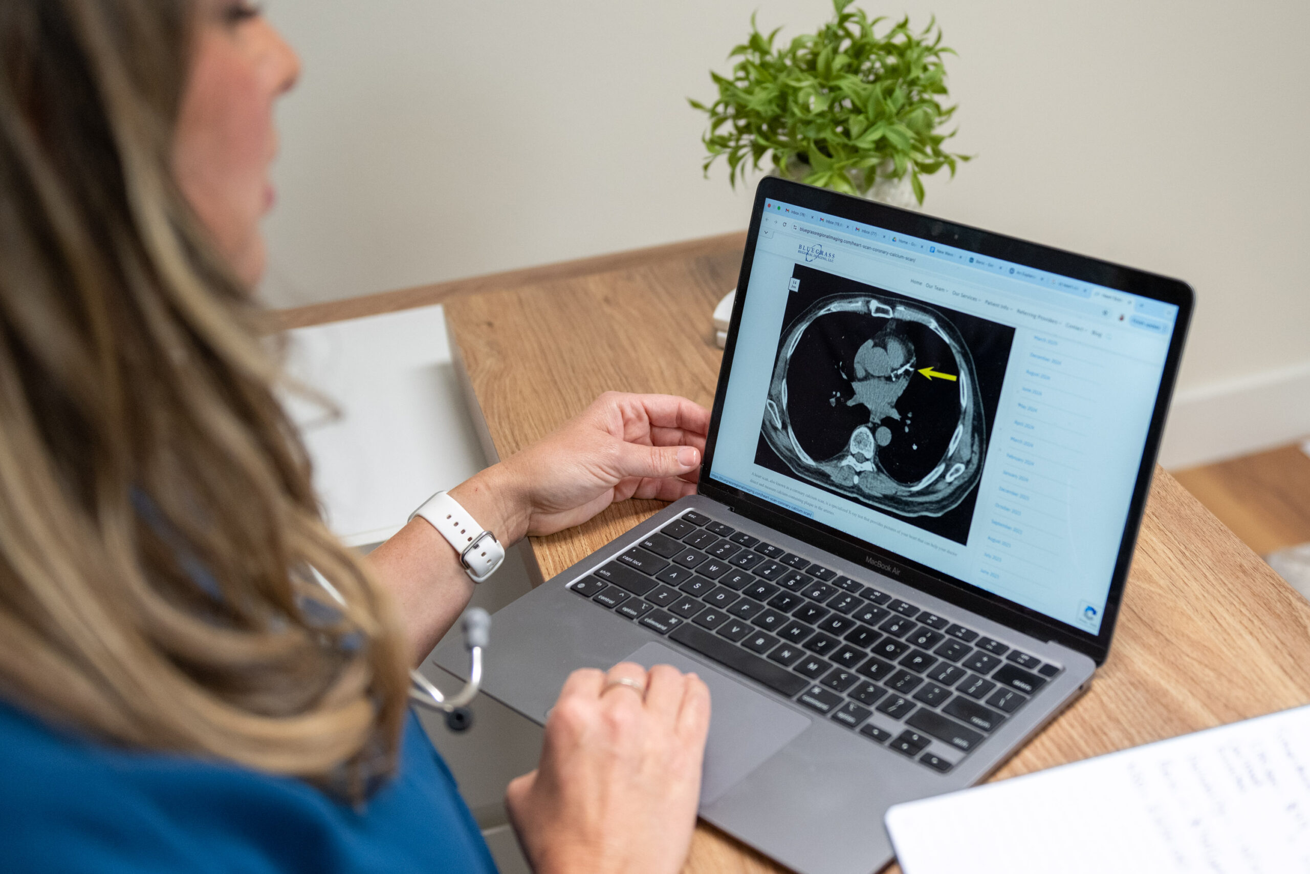 CT Heart Calcium Scan: The Key to Knowing Your Cardiovascular Risk Before Symptoms Start